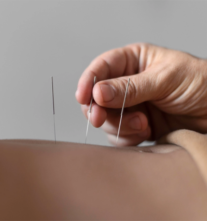 Linaldo Fisio Integrada - Niterói RJ // Fisioterapeuta em Niterói RJ